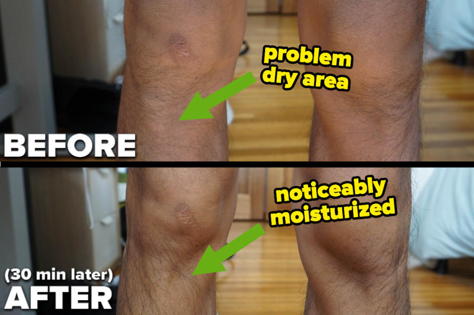 before and after of the author's knees looking noticeably moisturized afterward