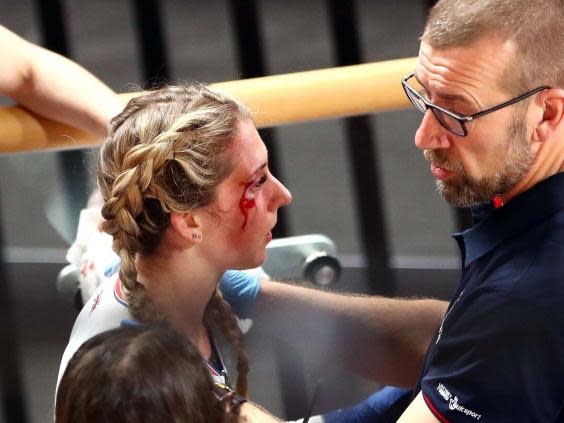 Great Britain's Laura Kenny with a cut on her face after crashing in the opening race of the Omnium (Tim Goode/PA Wire)