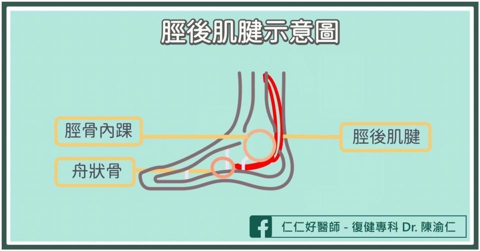 什麼是「脛後肌腱」？