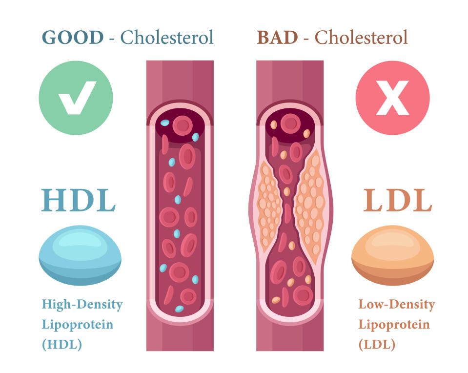 好膽固醇（圖左，高密度脂蛋白膽固醇，HDL）與壞膽固醇（圖右，低密度脂蛋白膽固醇，LDL）。（圖片來源：Getty Image）