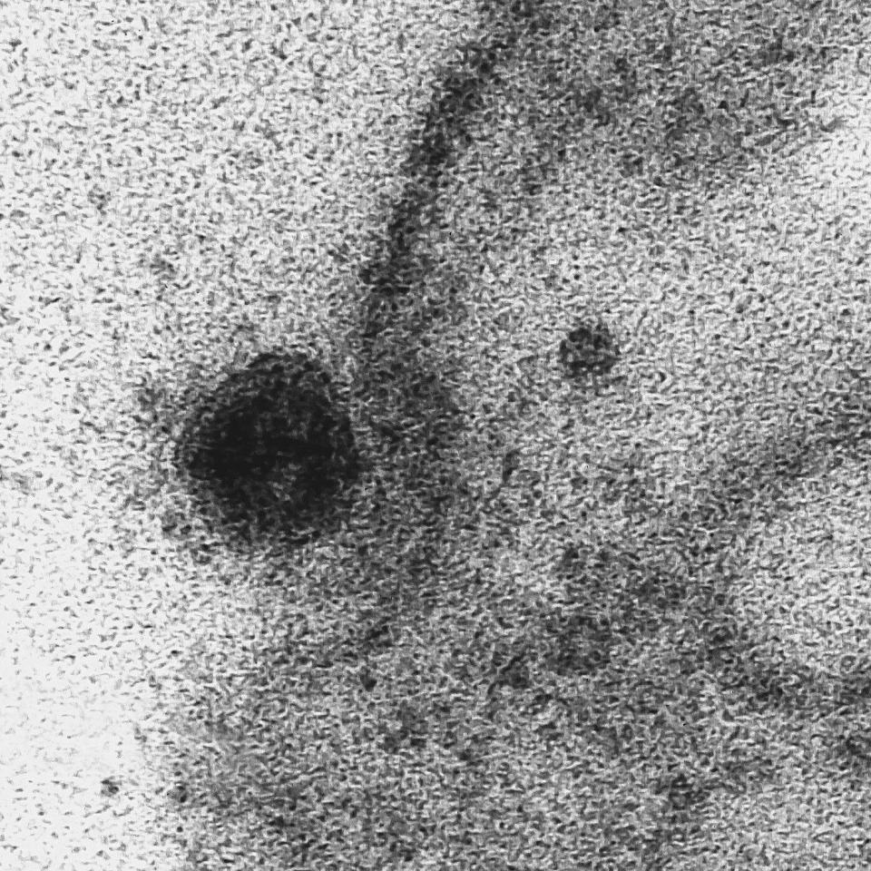 Brazilian scientists capture images of the exact moment when the new coronavirus infects a cell, Rio De Janeiro, Brazil - 08 Apr 2020 - DÃ©bora Barreto/FIOCRUZ/EPA-EFE