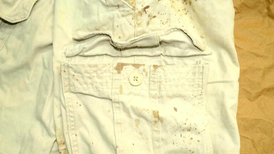 Dustin Parra's blood-spattered shorts. / Credit: Ducote Family