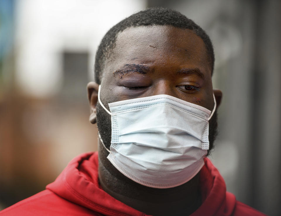 De'Vincent Spriggs stands outside of the Pittsburgh Police Zone 3 station on Wednesday, April 14, 2021, in Pittsburgh. Spriggs told Pittsburgh police Wednesday that Los Angeles Rams defensive lineman Aaron Donald and others assaulted the him at a nightclub last weekend, causing multiple injuries. (Steve Mellon/Pittsburgh Post-Gazette via AP)
