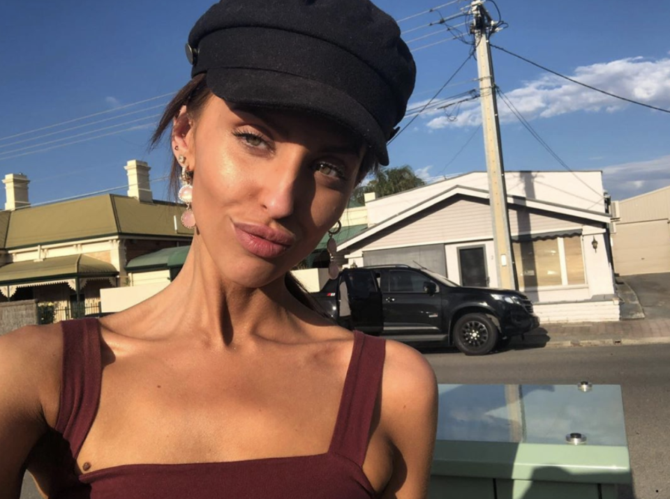 MAFS star Lizzie has opened up about a side effect of living with two chronic illnesses. Photo: Instagram/lizalizzieelizabeth/