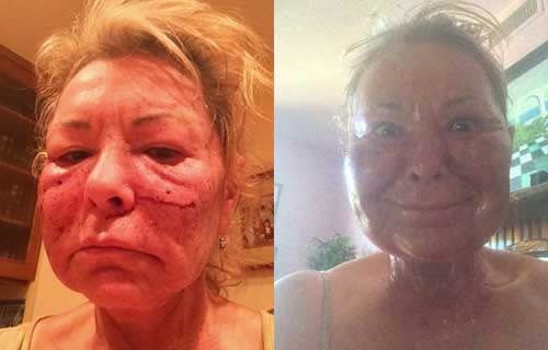 Roseanne Barr tweets some scary selfies. <i>Photo: Twitter</i>