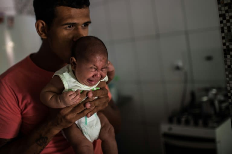 The mosquito-borne Zika virus has been linked to microcephaly -- a shrinking of the brain and skull -- in babies