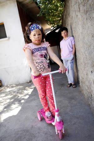 Limar Mekansi and her brother Gheis pose in front of their home in Ankara, Turkey, August 22, 2016. REUTERS/Tumay Berkin