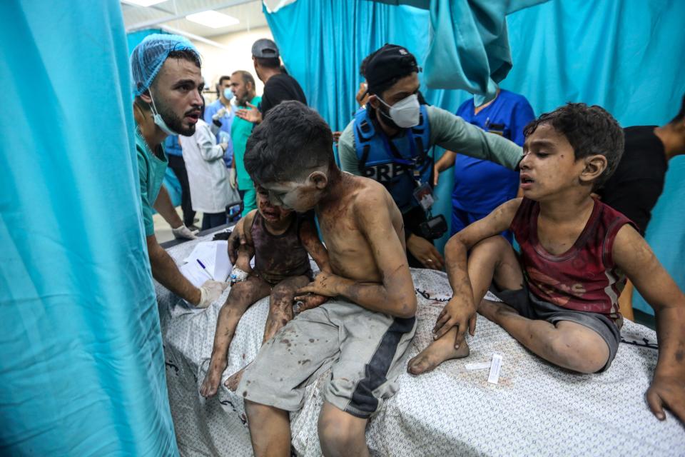 Palestinians injured in Israeli air raids arrive at Nasser Medical Hospital on October 24, 2023, in Khan Yunis, in the southern Gaza Strip. A brutal Hamas attack in southern Israel on Oct. 7 sparked retaliatory strikes in which thousands have died and hundreds of thousands have been displaced.