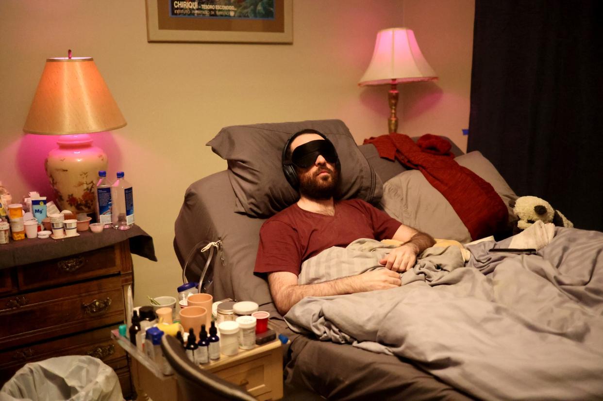 In this file photo, James Strazza, of Beaufort, SC, struggles with chronic fatigue syndrome also known as myalgic encephalomyelitis, which has taken over his life since 2008. Severe “brain pain” can be caused by any stimuli, so in order to have the lights on in his room he must cover his eyes with a mask.