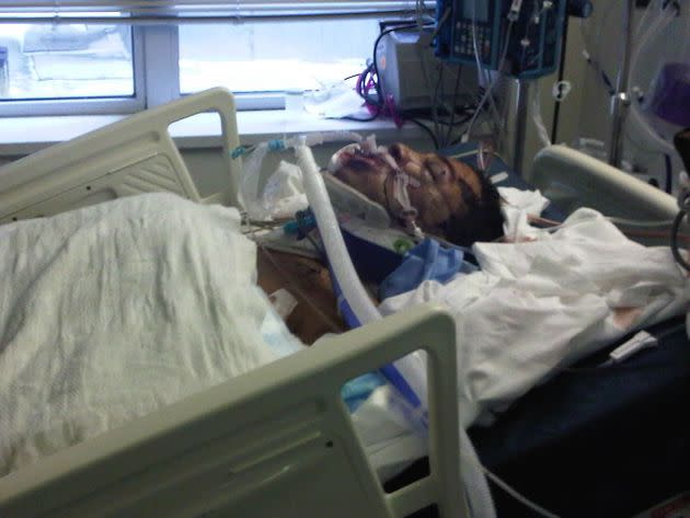 The author at the Elmhurst Trauma Hospital in New York City, approximately 12 hours after he was struck by a subway train in December 2010. (Photo: Courtesy of Patrick Labossiere)