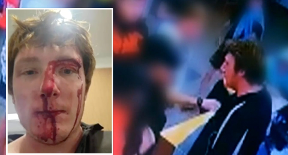 Left: Khoby Dawson, 22, is pictured showing a bloody and cut face after an alleged McDonald's brawl at Raymond Terrace. Right: A video still shows him being confronted by the group.