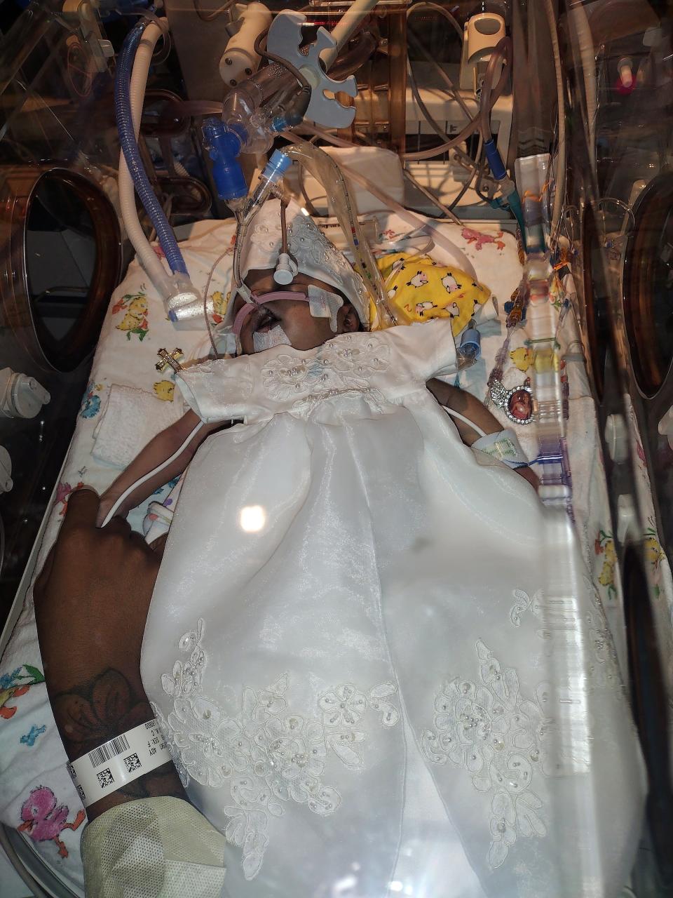 The morning of Sept. 19, 2021, Amillianna Ramirez-Johnson is seen connected to a breathing apparatus and monitoring devices in the neonatal intensive care unit at Columbia St. Mary's Hospital.