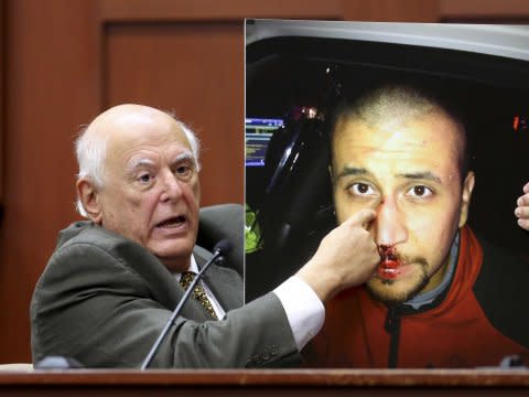 George Zimmerman