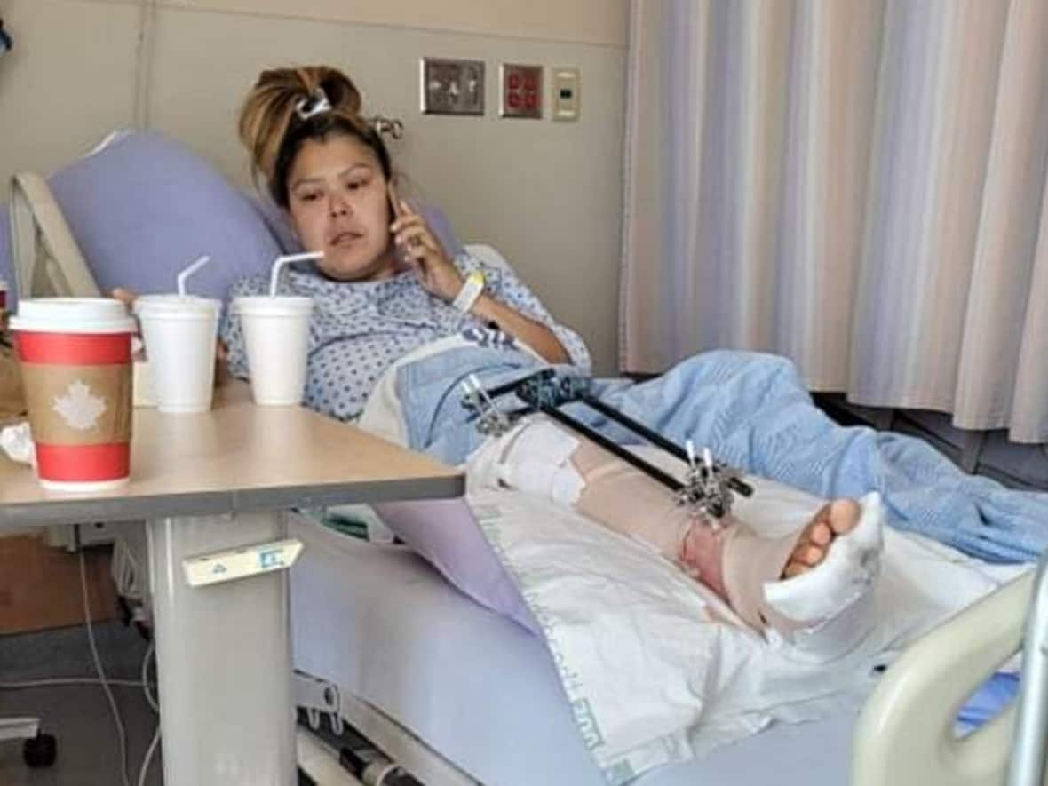 Lindsey Tom is demanding accountability after she says she suffered a broken leg during an arrest by RCMP officers and was left screaming in pain overnight in a jail cell. (Submitted by Lindsey Tom - image credit)