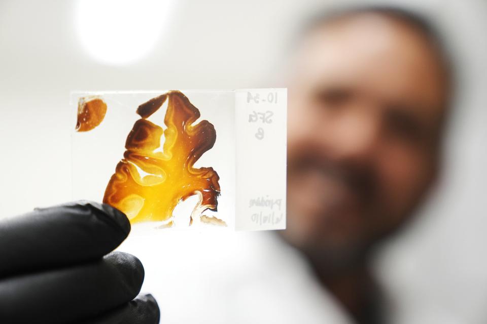 ASU professor Diego Mastroeni holds a slide from a donor brain with visible plaque at Arizona State University’s Biodesign Institute in Tempe, Ariz., on Feb. 22, 2023.