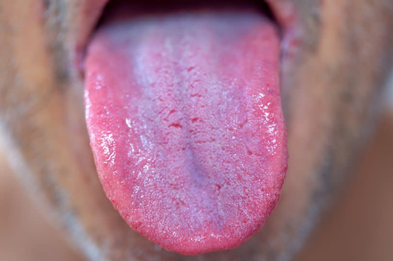 You tongue may be telling you something important about your health