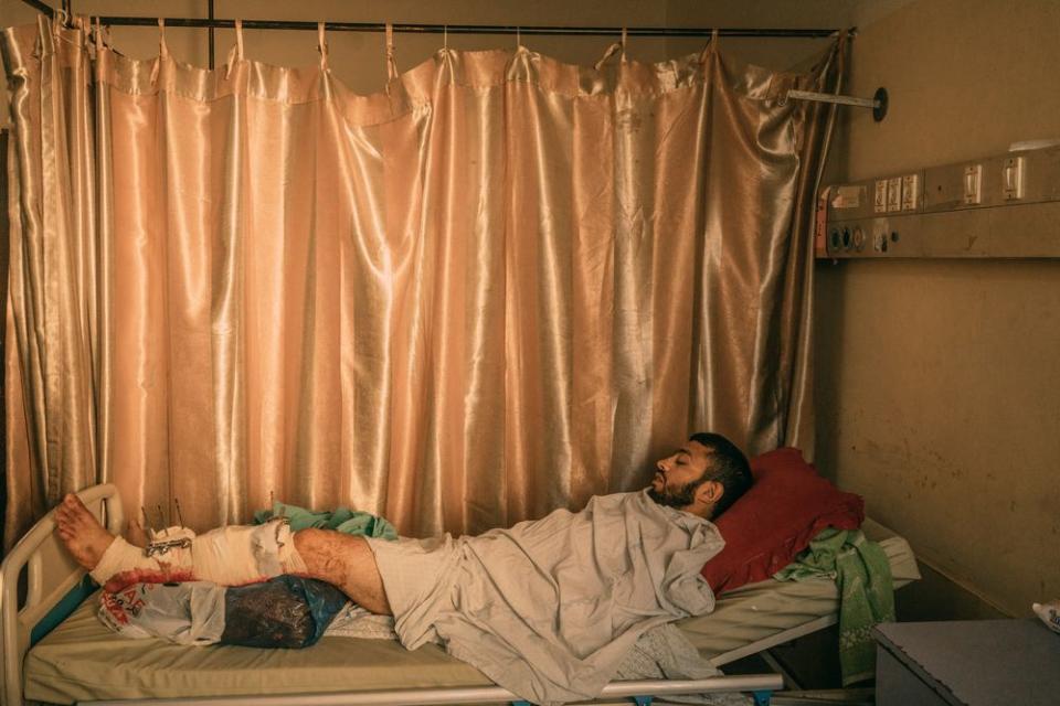 Ibrahim Dahir, 32, whose left leg was injured by Israeli troops during the protest, lays in a bed at Shifa Hospital in Gaza City.