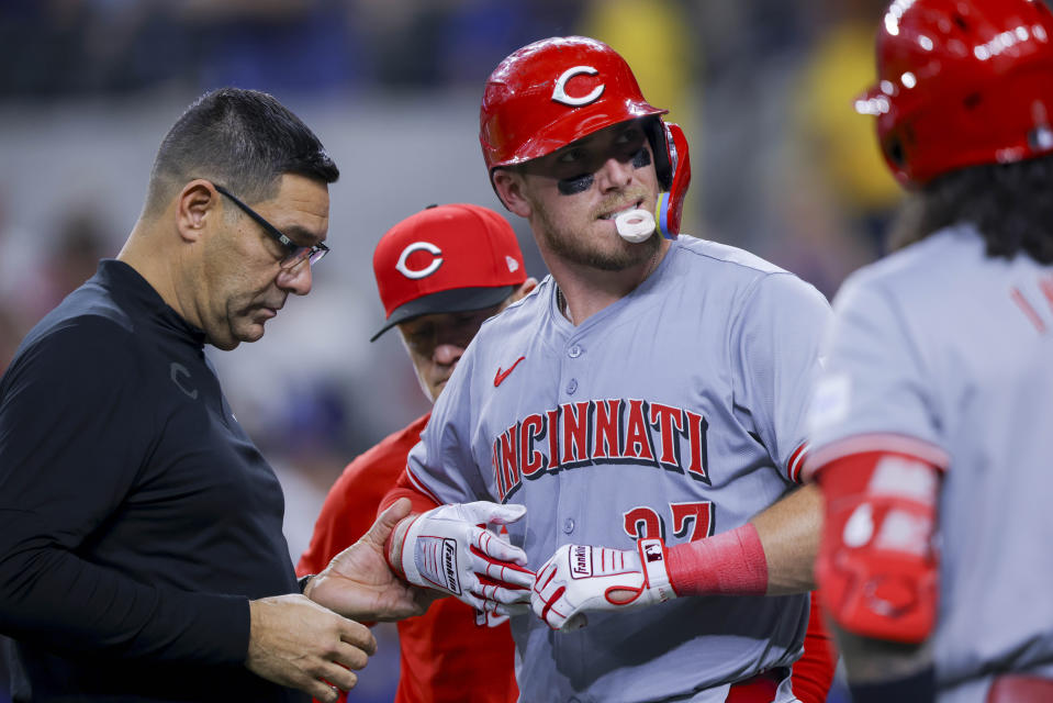 Cincinnati Reds' Tyler Stephenson, center, has his hand inspected after he was hit by a pitch during the seventh inning of a baseball game against the Texas Rangers in Arlington, Texas, Saturday, April 27, 2024. (AP Photo/Gareth Patterson)