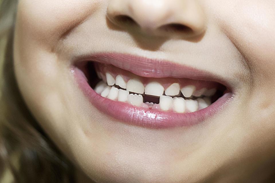 Mental health problems can be diagnosed using children’s teeth, scientists suggest