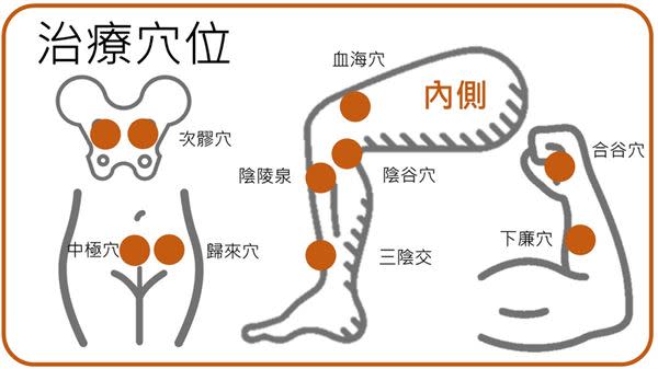 超痛的子宮內膜異位，中醫有幫助嗎？