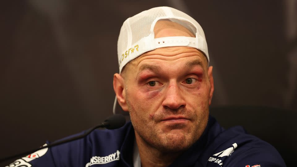 Tyson Fury suffered his first ever loss in professional boxing. - Richard Pelham/Getty Images