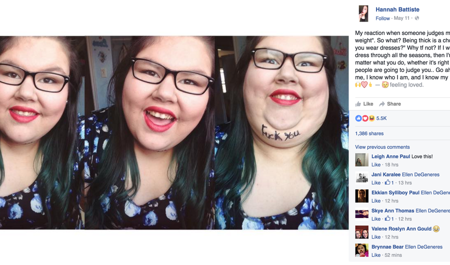 This Woman's Body Shaming Clapback Written on Her Chin Lit Up the Internet 