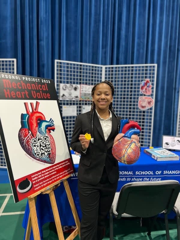 Simmonds recently completed a school assignment that involved creating a 3D model of an artificial heart valve.