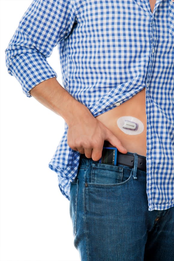 Dexcom receiver and patch on a man body