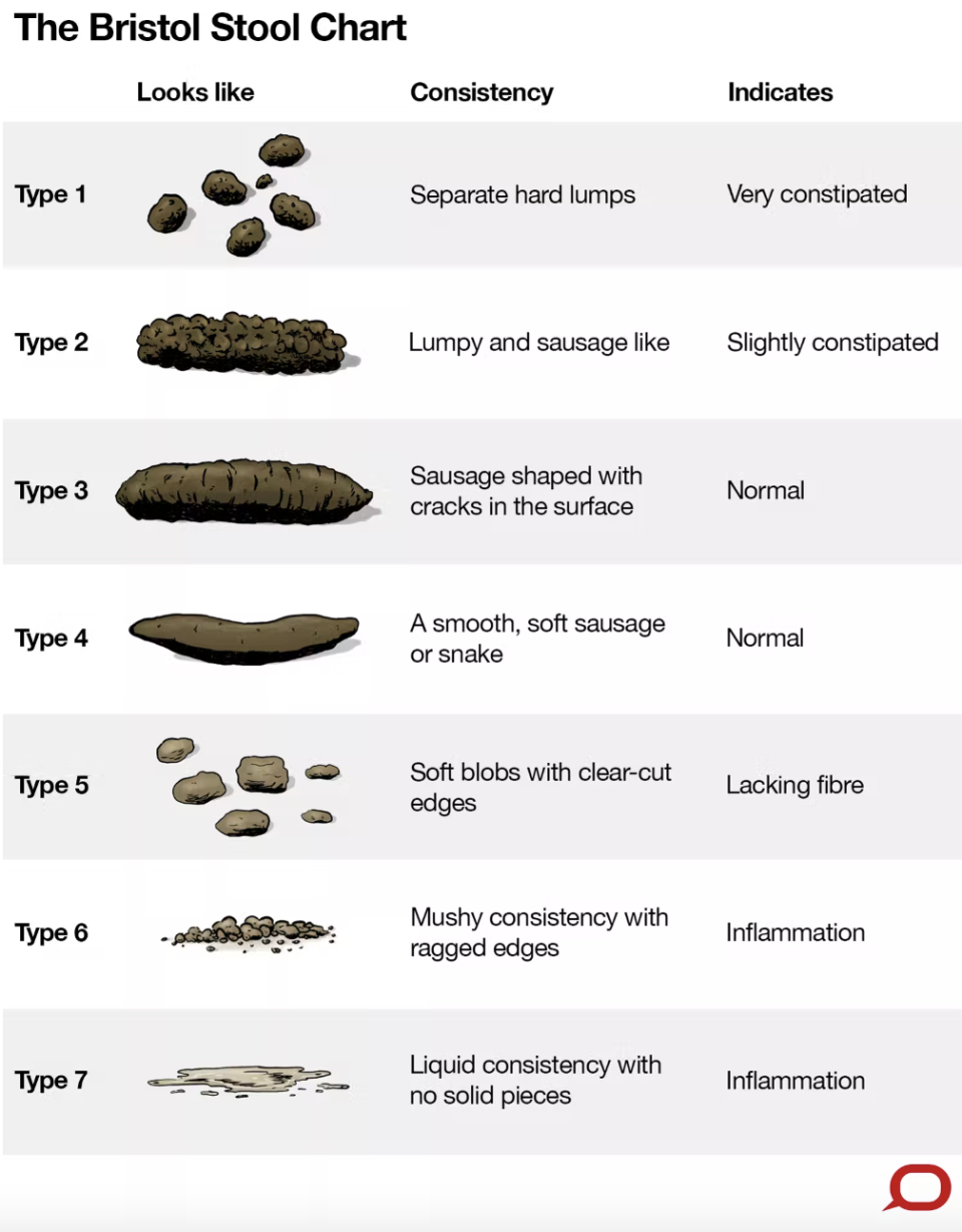 How does your poo compare? Source: The Conversation/CC BY-ND