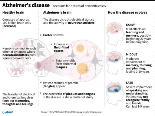 How Alzheimer's disease develops