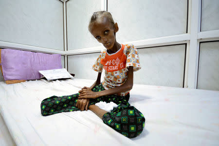 Saida Ahmad Baghili, 18, who is affected by severe malnutrition, sits on a bed at the al-Thawra hospital in the Red Sea port city of Hodeidah, Yemen October 24, 2016. REUTERS/Abduljabbar Zeyad/File Photo