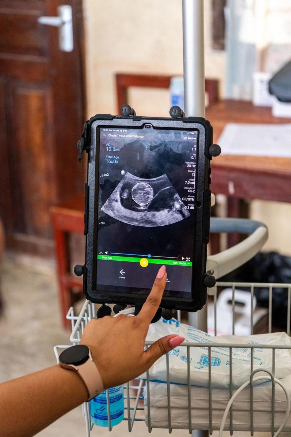 PHOTO: The Bill & Melinda Gates Foundation is working to increase access globally to AI-enabled ultrasound devices. (The Bill & Melinda Gates Foundation)