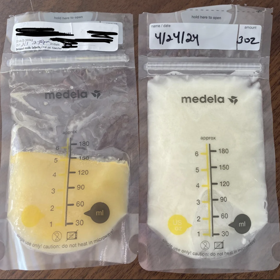 Two labeled breast milk storage bags with measurements, one partially filled
