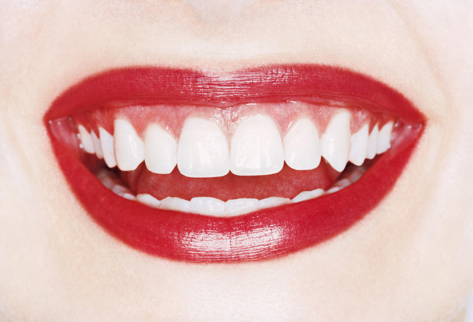 Get the bright white smile of your dreams. (Photo: Amazon)