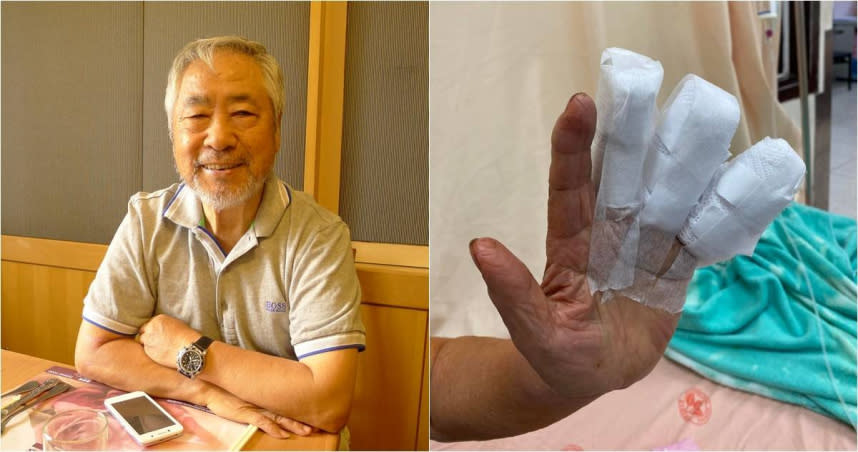 氣象專家李富城高齡已經86歲，他最近自爆三根手指頭因為做包子用機器壓麵團，不慎壓扁三根手指頭。 （圖／翻攝李富城臉書）