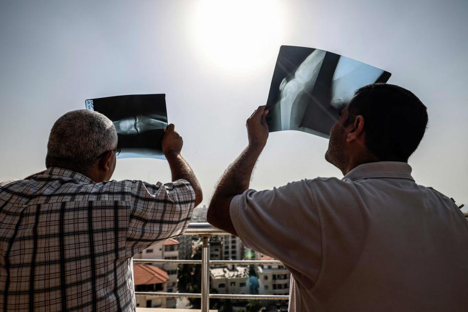 Men use X-ray images as filters to view a partial solar eclipse visible from Gaza City in the Palestinian Gaza Strip enclave on Oct. 25, 2022.