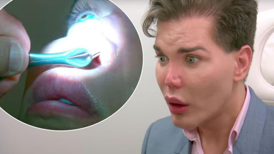 Rodrigo was told his nose might fall off and die after an examination on 'Botched'. Photo: E! Entertainment