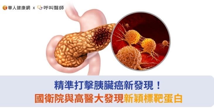 精準打擊胰臟癌新發現！國衛院與高醫大發現新穎標靶蛋白