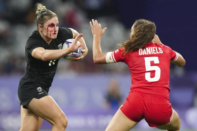 La back de Nueva Zelanda, Michaela Blyde, corre con el balón con la cara ensangrentada contra la back de Canadá, Chloe Daniels durante la segunda mitad del partido femenino de Rugby Sevens Pool A en los Juegos Olímpicos de 2024