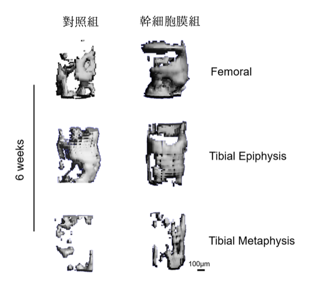 電腦掃描影像顯示，使用幹細胞膜的一組比對照組，不論在股骨（femoral）或脛骨兩端（tibial epiphysis ）及 脛骨端和骨幹中間部分（tibial metaphysis）都有更多骨細胞在骨隧道內形成，有助骨與韌帶融合。