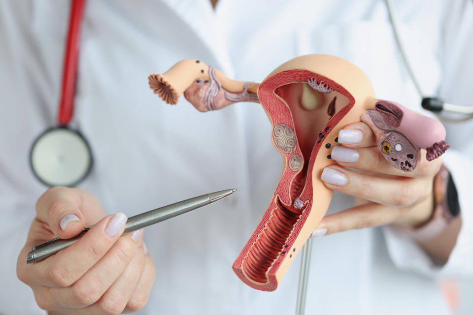 doctor holding a model of a uterus