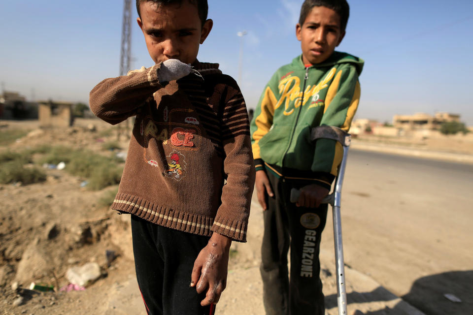 Injured brothers at checkpoint near Mosul, Iraq