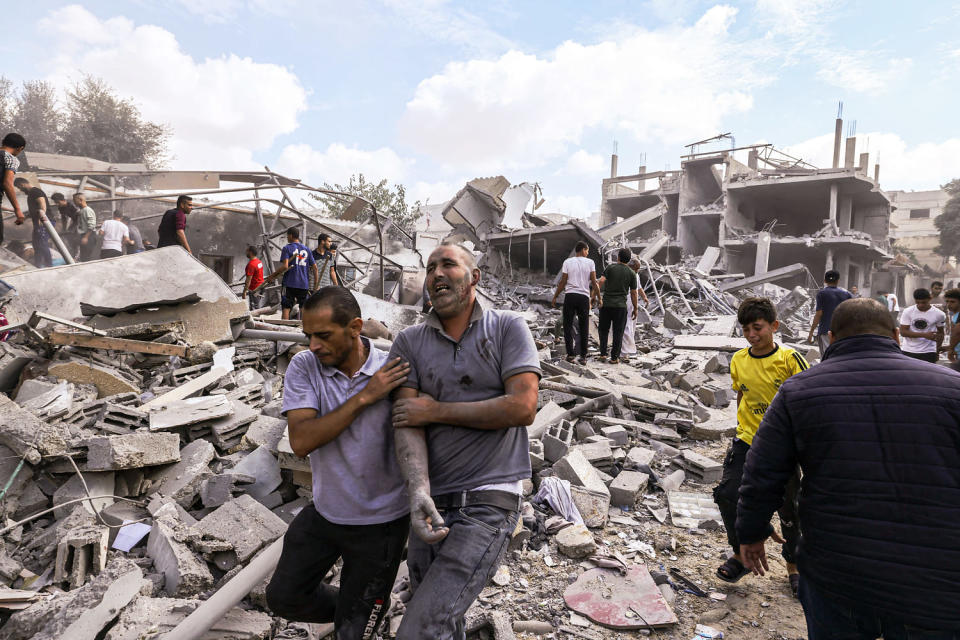 israel hamas conflict palestinians injury (Mohammed Abed / AFP - Getty Images)