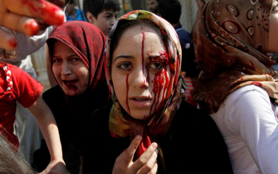 Injured Syrian women arrive at a field hospital after an air strike hit their homes in the town of Azaz, in 2012 (file photo) - AP Photo/Khalil Hamra, File