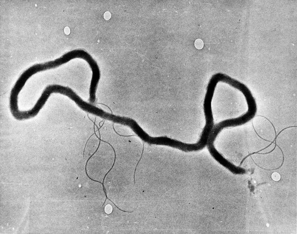 In this May 23, 1944 file photo, the organism treponema pallidum, which causes syphilis, is seen through an electron microscope.