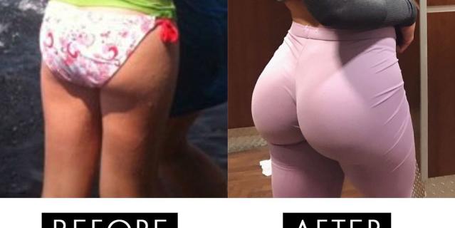 639px x 320px - How This Woman Turned Her Butt Into A Booty
