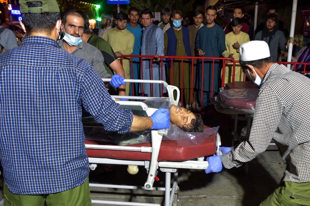 EDITORS NOTE: Graphic content / Volunteers and medical staff bring an injured man on a stretcher to a hospital for treatment after two powerful explosions, which killed at least six people, outside the airport in Kabul on August 26, 2021. / AFP / Wakil KOHSAR