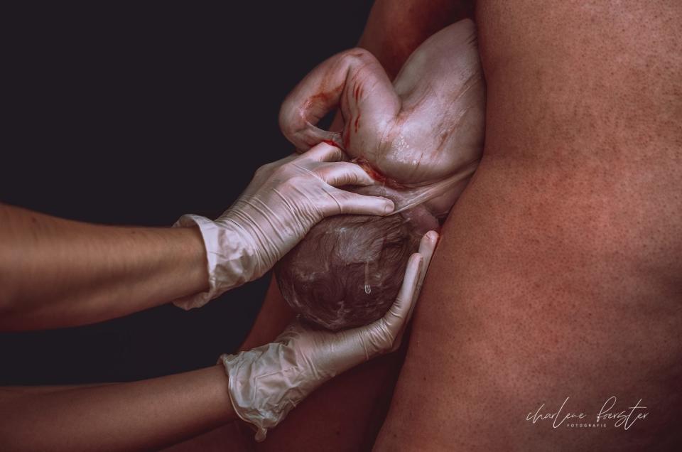 Childbirth photos