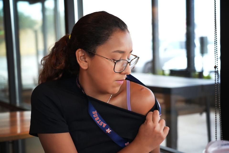 Miah Cerrillo shows bullet fragments that are still in her shoulder and her back from the day a gunman opened fire at Robb Elementary School, killing 19 of her classmates.