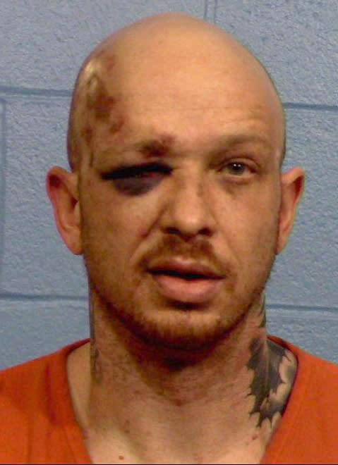 Image: Injuries sustained by Ramsey Mitchell after his encounter with Williamson County Sheriff's Deputies in June 2019. (Williamson County Sheriff's Office)